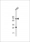 STT3A Antibody (Center)